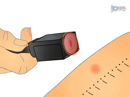 Determining heat and mechanical pain threshold in inflamed skin of human subjects