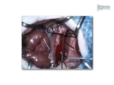 Creation of Murine Experimental Abdominal Aortic Aneurysms with Elastase 