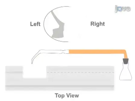 Combining Peripheral Nerve Grafting and Matrix Modulation to Repair the Injured Rat Spinal Cord