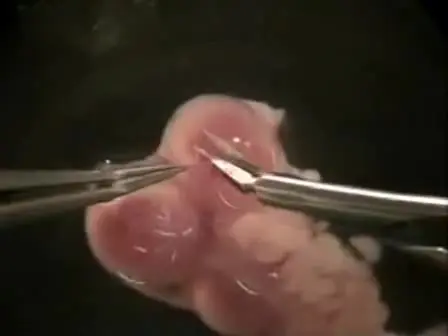Mouse Dorsal Forebrain Explant Isolation
