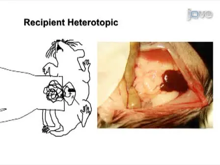 Heterotopic and Orthotopic Tracheal Transplantation in Mice used as Models to Study the Development of  Obliterative Airway Disease