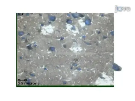 Obtaining High Quality RNA from Single Cell Populations in Human Postmortem Brain Tissue