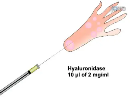 DNA Transfection of Mammalian Skeletal Muscles using <em>In Vivo</em> Electroporation