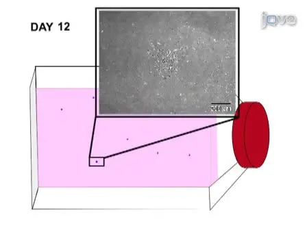Isolation and Large Scale Expansion of Adult Human Endothelial Colony Forming Progenitor Cells