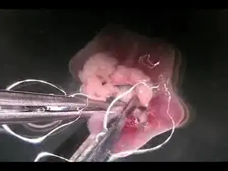 Dissection of 6.5 dpc Mouse Embryos