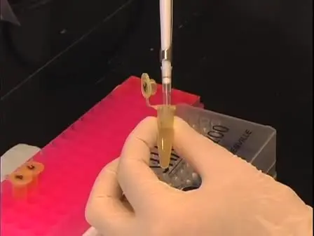 Tracheotomy: A Method for Transplantation of Stem Cells to the Lung