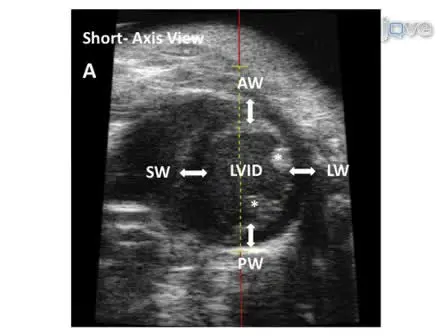 Transthoracic Echocardiography in Mice