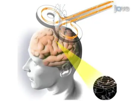 A Novel Approach for Documenting Phosphenes Induced by Transcranial Magnetic Stimulation