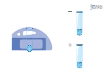 Isolation and Enrichment of Rat Mesenchymal Stem Cells (MSCs) and Separation of Single-colony Derived MSCs