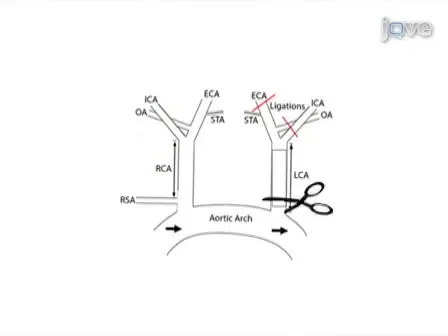 A Model of Disturbed Flow-Induced Atherosclerosis in Mouse Carotid Artery by Partial Ligation and a Simple Method of RNA Isolation from Carotid Endothelium