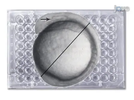 Labeling and Imaging Cells in the Zebrafish Hindbrain