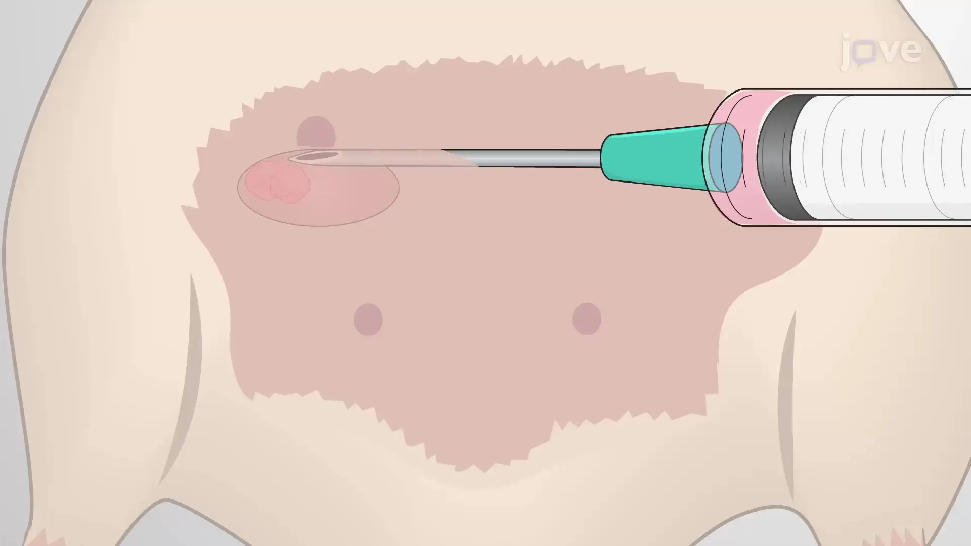 Orthotopic Injection into the Mammary Fat Pad:  Establishing Breast Cancer in Mice