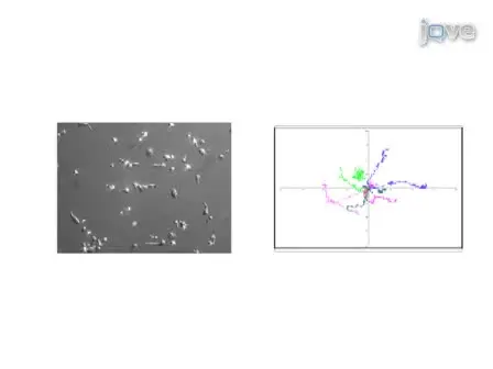 Human T Lymphocyte Isolation, Culture and Analysis of Migration <em>In Vitro</em>