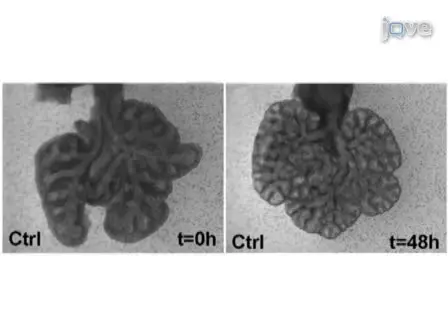 Mouse Embryonic Lung Culture, A System to Evaluate the Molecular Mechanisms of Branching