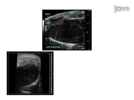 Murine Echocardiography and Ultrasound Imaging