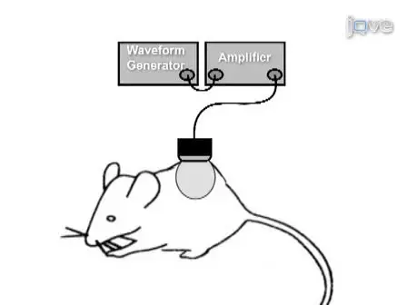 Contrast Ultrasound Targeted Treatment of Gliomas in Mice via Drug-Bearing Nanoparticle Delivery and Microvascular Ablation