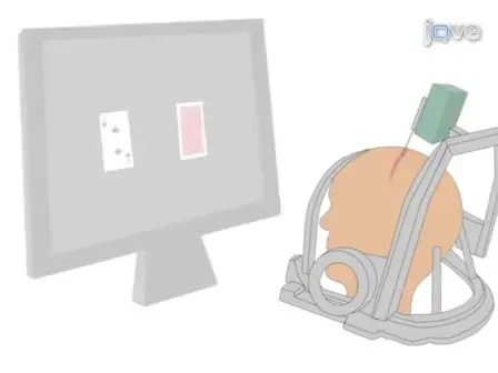 Intra-Operative Behavioral Tasks in Awake Humans Undergoing Deep Brain Stimulation Surgery