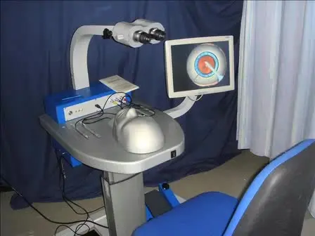 A Novel Technique of Rescuing Capsulorhexis Radial Tear-out using a Cystotome
