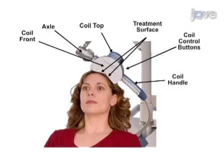 The NeuroStar TMS Device: Conducting the FDA Approved Protocol for Treatment of Depression