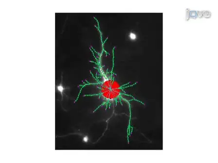 Automated Sholl Analysis of Digitized Neuronal Morphology at Multiple Scales