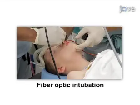 Guidelines for Elective Pediatric Fiberoptic Intubation