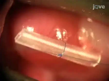 Coronary Artery Ligation and Intramyocardial Injection in a Murine Model of Infarction