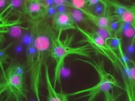Counting Human Neural Stem Cells