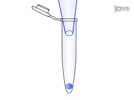 Transcriptome Analysis of Single Cells