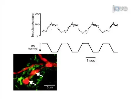Physiological, Morphological and Neurochemical Characterization of Neurons Modulated by Movement