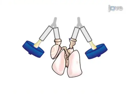 Procedure for Lung Engineering