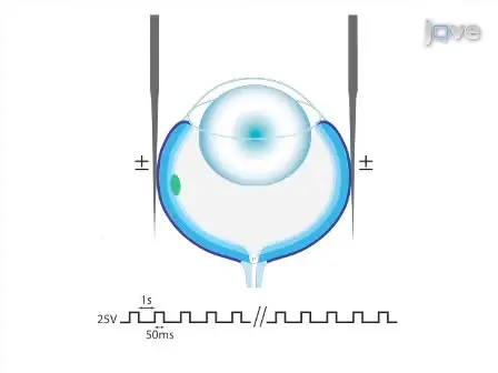 Transfection of Mouse Retinal Ganglion Cells by <em>in vivo</em> Electroporation