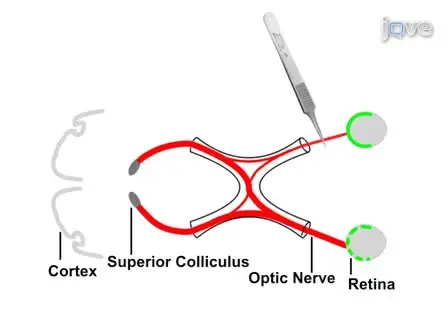 An Optic Nerve Crush Injury Murine Model to Study Retinal Ganglion Cell Survival