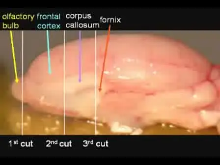 Micro-dissection of Rat Brain for RNA or Protein Extraction from Specific Brain Region