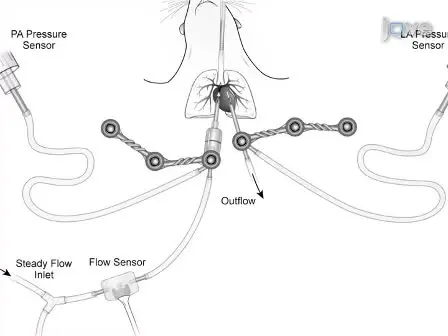 Characterization of the Isolated, Ventilated, and Instrumented Mouse Lung Perfused with Pulsatile Flow