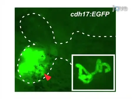 Transplantation of Cells Directly into the Kidney of Adult Zebrafish