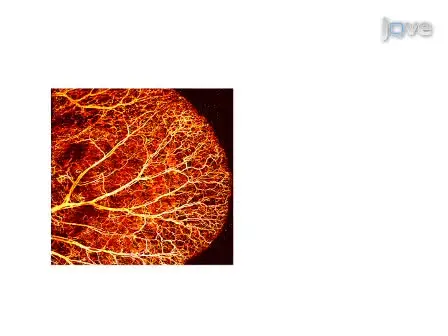 Three-dimensional Optical-resolution Photoacoustic Microscopy