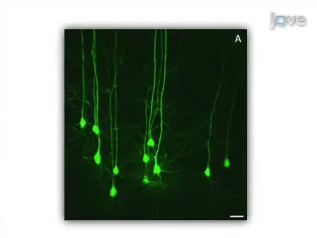A Rapid Approach to High-Resolution Fluorescence Imaging in Semi-Thick Brain Slices