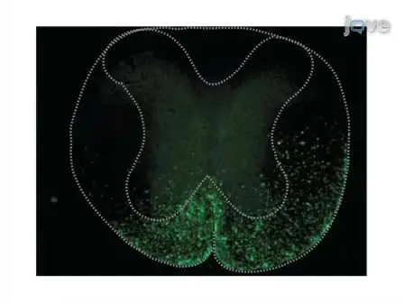 Surgical Transplantation of Mouse Neural Stem Cells into the Spinal Cords of Mice Infected with Neurotropic Mouse Hepatitis Virus