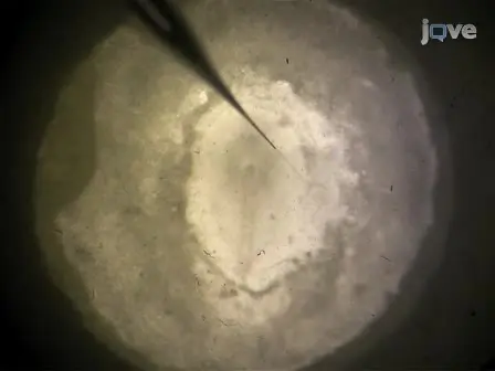 Tracking Morphogenetic Tissue Deformations in the Early Chick Embryo 
