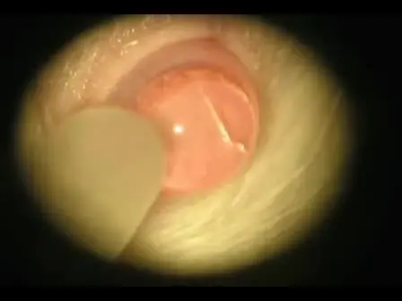 Intravitreous Injection for Establishing Ocular Diseases Model