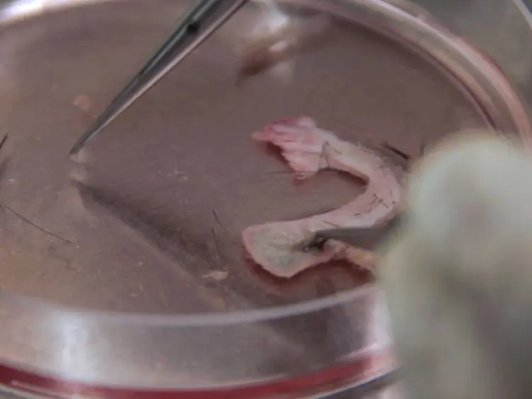 Isolation and Culture of Neural Crest Stem Cells from Human Hair Follicles