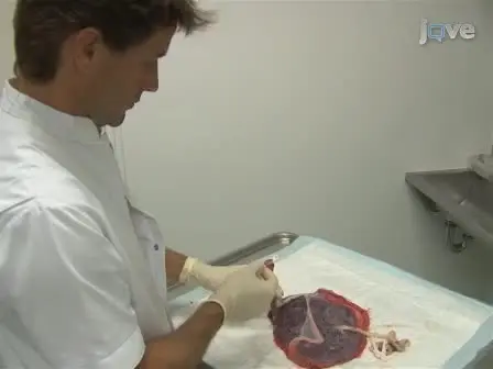 Accurate and Simple Evaluation of Vascular Anastomoses in Monochorionic Placenta using Colored Dye