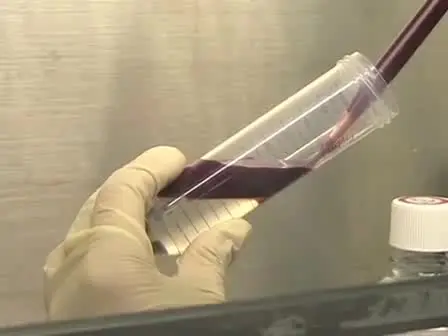 Enrichment of NK Cells from Human Blood with the RosetteSep Kit from StemCell Technologies
