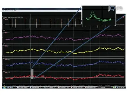 Recording Large-scale Neuronal Ensembles with Silicon Probes in the Anesthetized Rat