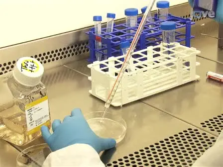 Spheroid Assay to Measure TGF-β-induced Invasion
