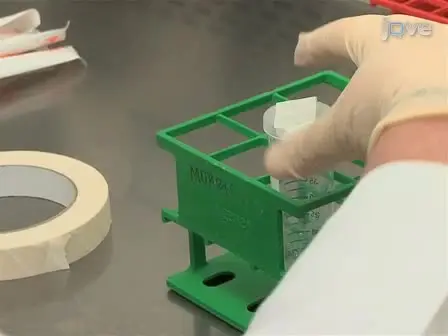 Rotating Cell Culture Systems for Human Cell Culture: Human Trophoblast Cells as a Model