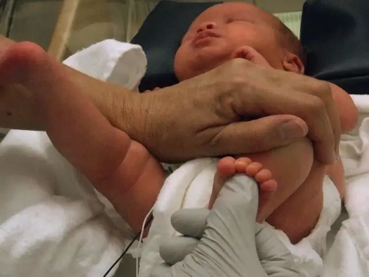 Assessment and Evaluation of the High Risk Neonate: The NICU Network Neurobehavioral Scale