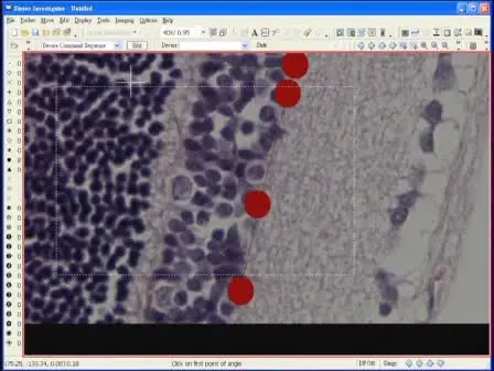Morphometric Analyses of Retinal Sections