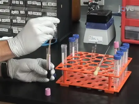 Detection and Isolation of Circulating Melanoma Cells using Photoacoustic Flowmetry