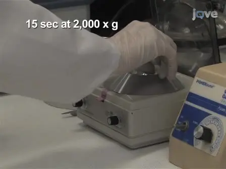 Amide Hydrogen/Deuterium Exchange &amp; MALDI-TOF Mass Spectrometry Analysis of Pak2 Activation